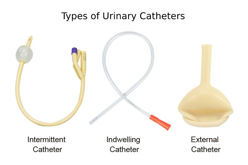 Types of Urinary Catheters Types of Urinary Catheters