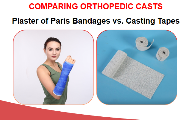 Differences Between Plaster Bandages And Casting Tapes