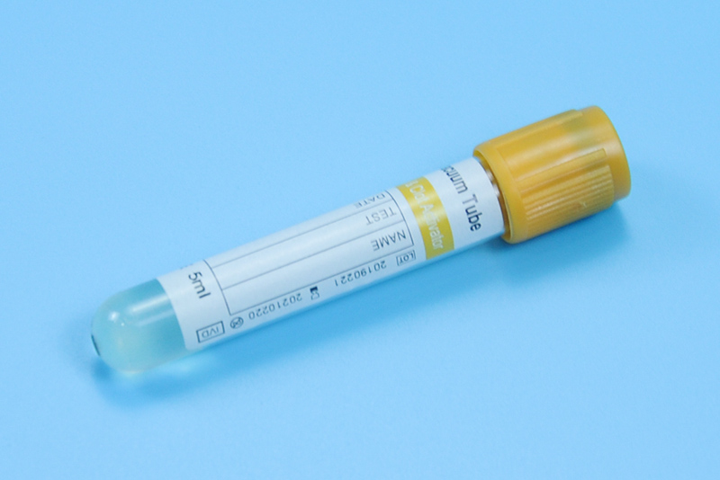 Gel & Clot Activator Vacuum Tube 